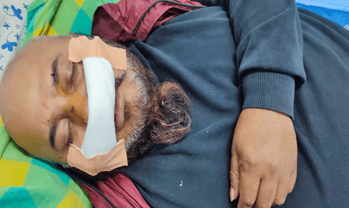देउवा पक्ष र पौडेलपक्षबीच झडप, पौडेल पक्षका नेताको नाकको हड्डी फ्याक्चर
