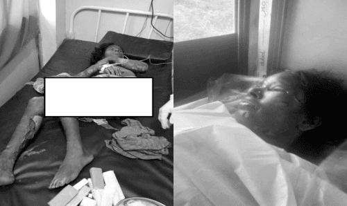 देवरले भाउजुलाई पेट्रोल छर्केर जिउँदै जलाए !