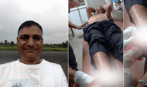 प्रहरीका डिएसपी यादवलाई चोटैया, कसले भाँचिदियो खुट्टा ?