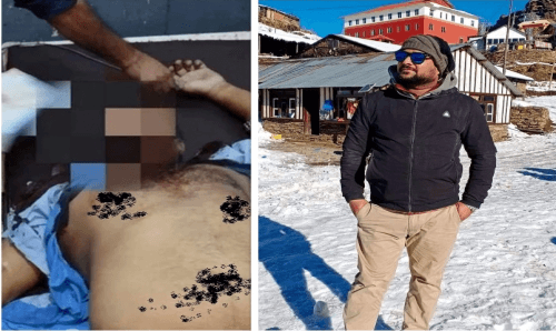 बाराको मदर्सा टोलमा दिनदहाडै एक युवकलाई गोली हानी हत्या !