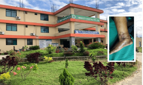 सिरहाको आरके मेडिसिटीमा डा. शर्माले जबरदस्ती गरिदिए खुट्टाको अप्रेशन, २५ हजार पठाएपछि...