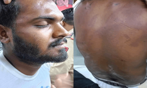 सुनसरीमा अल्लाह हु–अकबर भन्दै मुस्लिम समुदायका युवकहरुले गरे सांघातिक आक्रमण, अवस्था गम्भिर