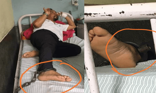 सांसद रेशम चौधरीको खुट्टामा जंजिरले बाँधेर उपचार !