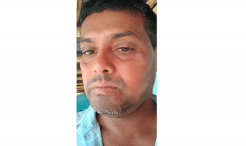 जातीय छुवाछुतको बिषयमा मुद्दा हालेपछि गाउँपालिका अध्यक्ष यादवले पुनः दलित कुटाए