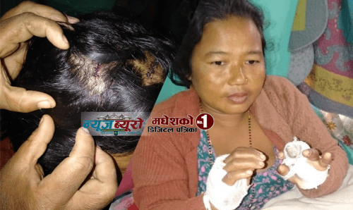 धनुषामा घरमा पसेर महिला उपर चक्कु प्रहार !