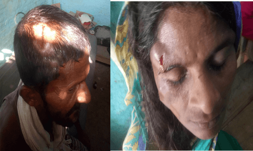 दुई 'यादव' परिवारबीच झडप, आधा दर्जन घाईते !