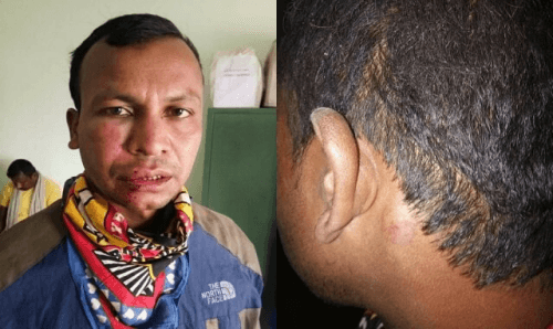 प्रदेश २ः 'राम' को अगाडी 'श्री' लगाउन वडाध्यक्षले मागे पैसा, नदिएपछि निर्घात कुटिए युवक