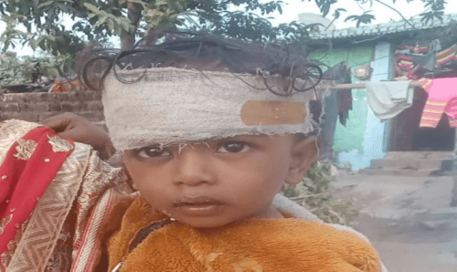 १ बर्षिय बालकलाई पत्थर प्रहार, टाउकोमा ८ वटा टाँका