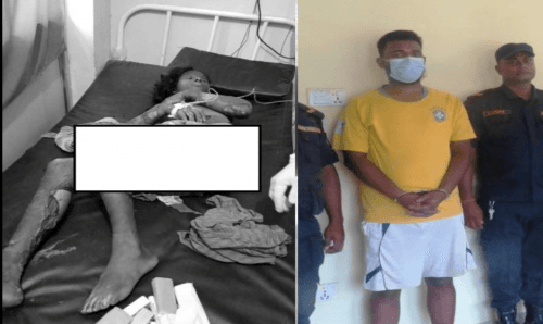 भाउजुलाई पेट्रोल छर्केर आगो लगाई मार्ने देवर पक्राउ !
