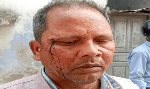 किशोरीको अर्धनग्न भिडियो टिकटोकमा पोष्ट गर्ने युवक बचाउ गर्दा कुटिए जसपा जिल्ला अध्यक्ष यादव